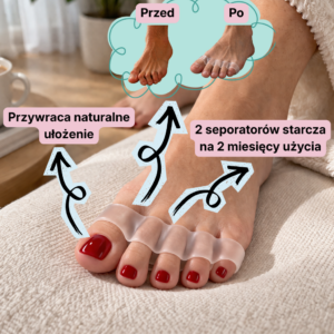 Vexless Correct - Separator dla palców nóg